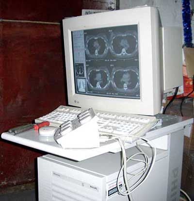 computer tomography, CT scan image